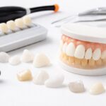 Types of Veneers Popular Among Patients in North York